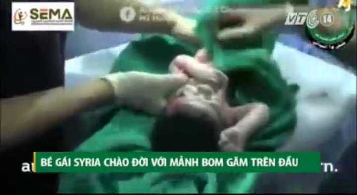 Bé sơ sinh được cứu sống thần kỳ khi mẹ bị trúng mảnh bom