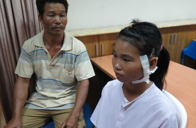 Nữ sinh 13 tuổi bị đạn bi bắn xuyên cổ