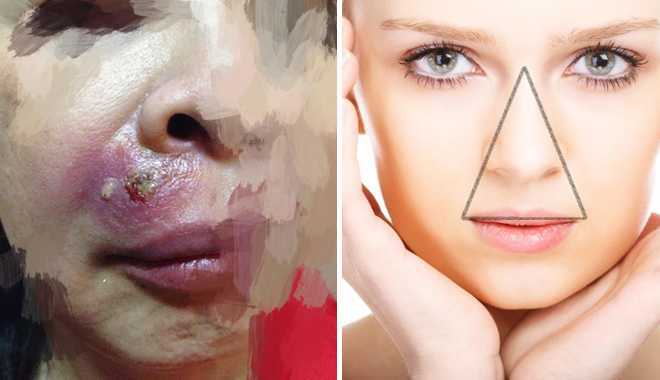 Bằng chứng vùng 'tam giác tử thần' trên mặt là có thật