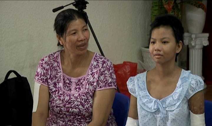 Bé gái bị mẹ tưới xăng đốt: 'Con chỉ muốn về nhà thôi'
