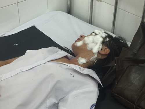 Nữ sinh bị tạt axit, hung thủ ra tay trong 30 giây