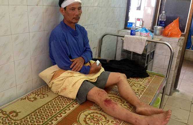 Vụ nổ giật sập 3 căn nhà: Các nạn nhân đã hồi phục