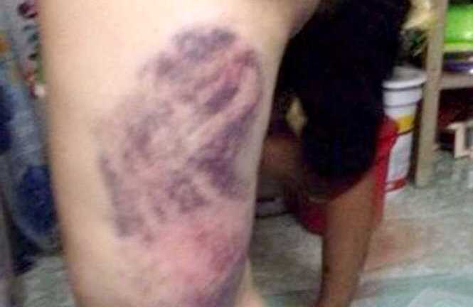 Đình chỉ công an đánh nữ công nhân không thừa nhận ăn trộm điện thoại