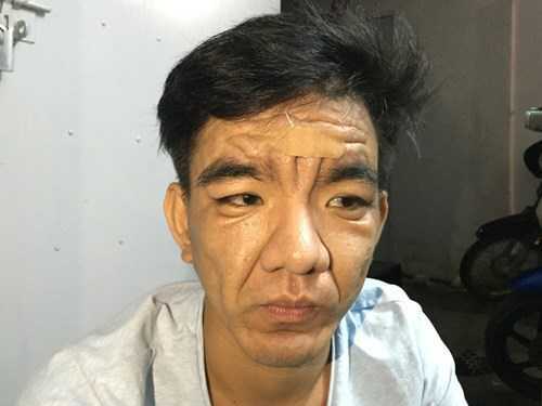 Bí ẩn căn bệnh người trẻ biến thành ông, bà lão: Chuyên gia lý giải