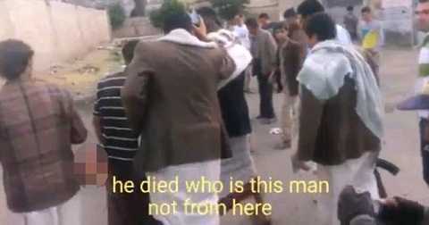 Rùng mình cảnh kẻ đánh bom IS vẫn nói dù bị đứt đôi người