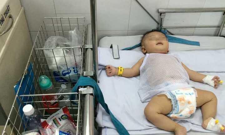 Chưa thể chẩn đoán chính xác bệnh tình của bé trai bị đâm xuyên não