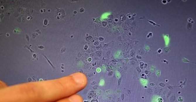 Phát hiện gen 'siêu vi khuẩn' nguy hiểm có trong thịt Trung Quốc