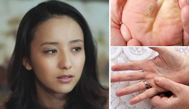 7 dấu hiệu cho thấy bạn đã bị ung thư cổ tử cung