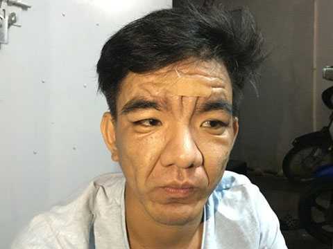 Rùng mình những căn bệnh hiếm gặp ở Việt Nam