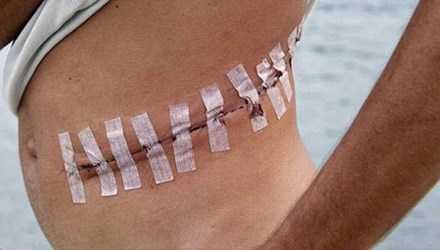 Ghê tởm tội ác IS: Cho phép lấy nội tạng từ tù nhân còn sống