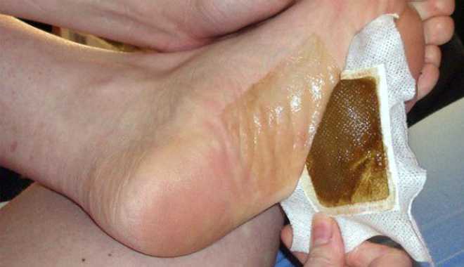 Tự làm miếng dán chân loại bỏ hết độc tố trong cơ thể chỉ sau một đêm