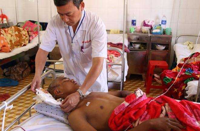 Lỡ bắn vào mắt bạn, thiếu niên dùng súng tự chế bắn vào đầu mình