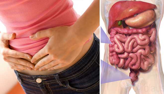 Cẩn thận với ruột già - sát thủ gây ra 90% bệnh tật trong cơ thể