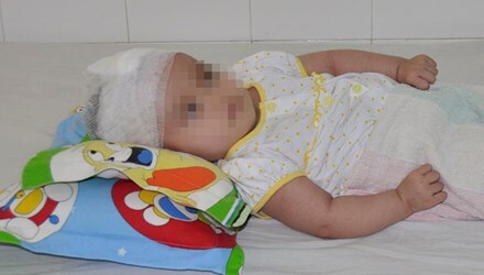 Truy tố bảo mẫu làm cháu bé chấn thương sọ não