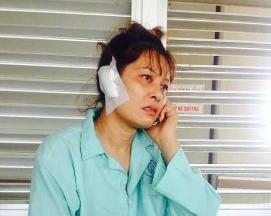 Gã đàn ông thú tính cắn đứt tai vợ