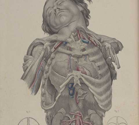 Xuyên thủng mắt, cắt não, chặt tay chân khi bệnh nhân tỉnh