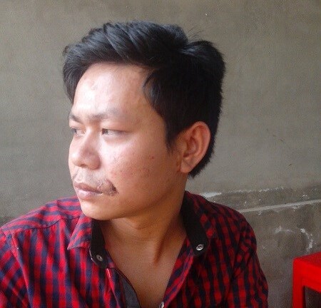 Cán bộ ấp côn đồ cắn rách môi trai trẻ