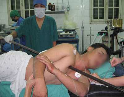 Nghi án sát hại người tình 16 tuổi bằng xà beng rồi tự vẫn