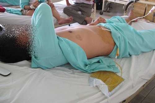 Vợ cắt phăng 'của quý' của chồng rồi bỏ trốn