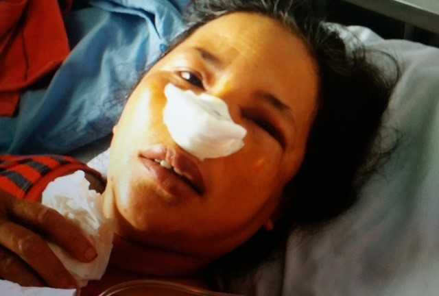 Tiểu thương bị nhân viên quản lý chợ đánh gãy sống mũi