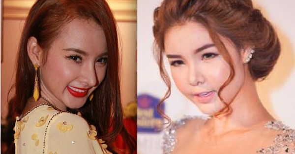 Loạt sao Việt biến dạng do phẫu thuật thẩm mỹ quá đà
