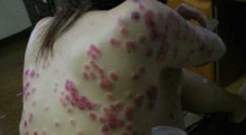 Quý bà khát tình dính bẫy phi công trẻ và căn bệnh nguy hiểm tính mạng