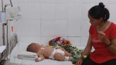 Đã có kết quả xét nghiệm của bé 5 tháng tuổi nghi bị não mô cầu tại Đắk Lắk