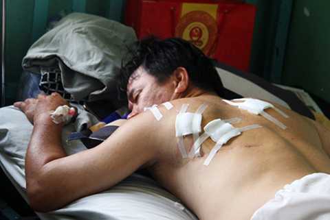 Côn dồ chém tới tấp chủ nhà hàng ở Nha Trang để 'dằn mặt'