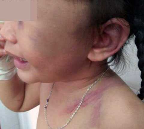 Nói cha dượng 'hút xì ke', bé 3 tuổi bị đánh ngất xỉu
