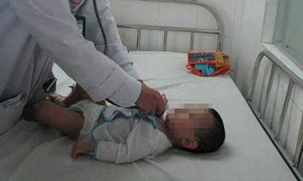 Hãi hùng phát hiện tụ điện trong phế quản bé 8 tháng tuổi