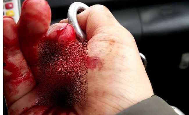 Cục Báo chí đề nghị Công an Hà Nội điều tra vụ nhà báo Đỗ Doãn Hoàng bị đánh