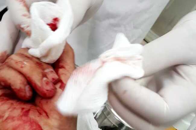 Nhà báo Đỗ Doàn Hoàng bị đánh dã man: Chủ tịch Hội nhà báo lên tiếng