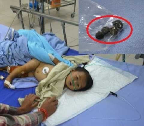 Bé gái 9 tháng tuổi bị chú bắn 6 viên đạn vào người