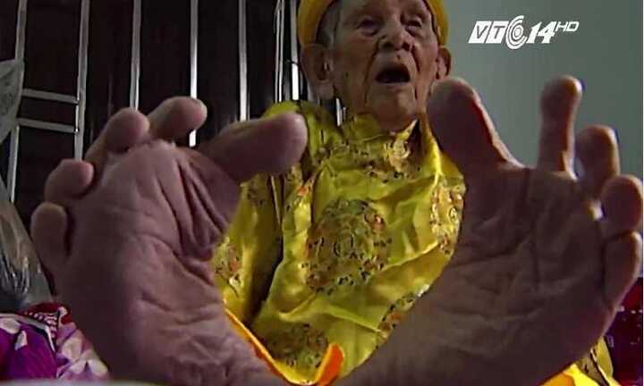 Video: Cụ ông cuối cùng có ‘đôi bàn chân Giao Chỉ’ ở Việt Nam
