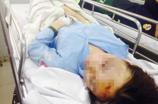 Hai cô gái bị tạt axit giữa Sài Gòn: Một người mù mắt, bỏng gần hết khuôn mặt