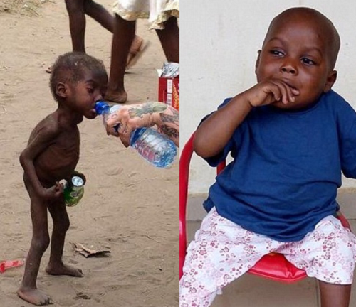 Thân hình mập mạp khó tin của cậu bé sắp chết đói cách đây 2 tháng