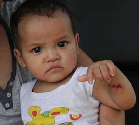 Bé gái 7 tháng tuổi bị đánh đập tại nhà trẻ