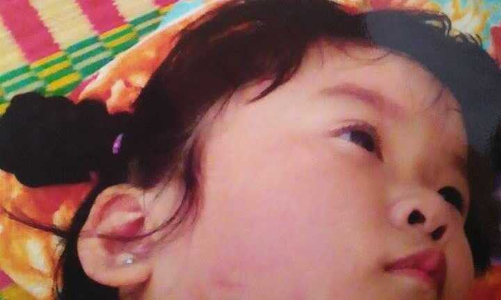 Phụ huynh tố cô giáo mầm non đánh bé gái 4 tuổi bầm mặt