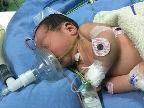 Hành trình vượt 1000km cứu sống bệnh nhi 3 ngày tuổi