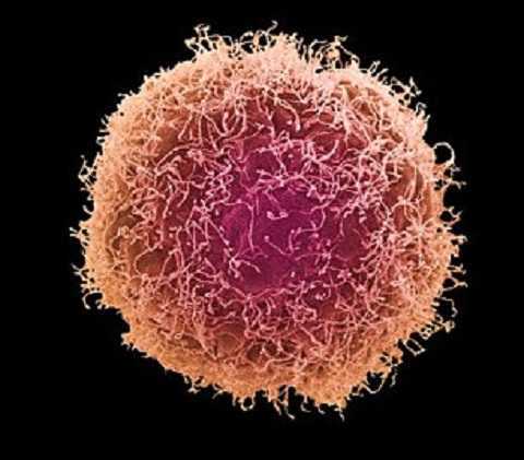 Cắt bỏ toàn bộ ‘của quý’ vì ung thư