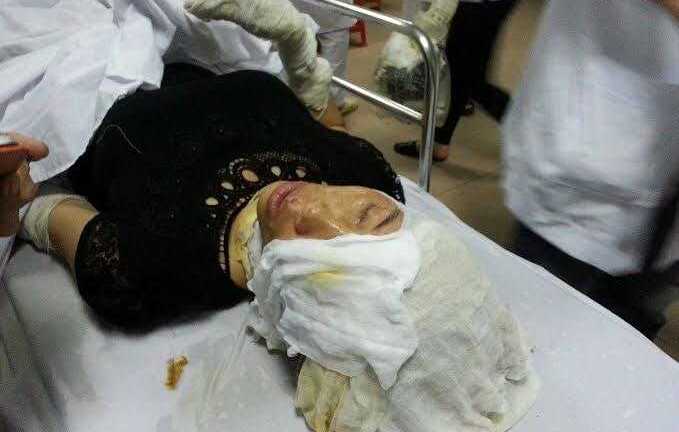 Nổ rung chuyển tại Nghệ An, la liệt người bị thương: Xác định nguyên nhân ban đầu