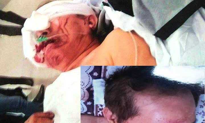 Bênh bố vợ, con rể vác mã tấu chém Việt kiều Mỹ trọng thương