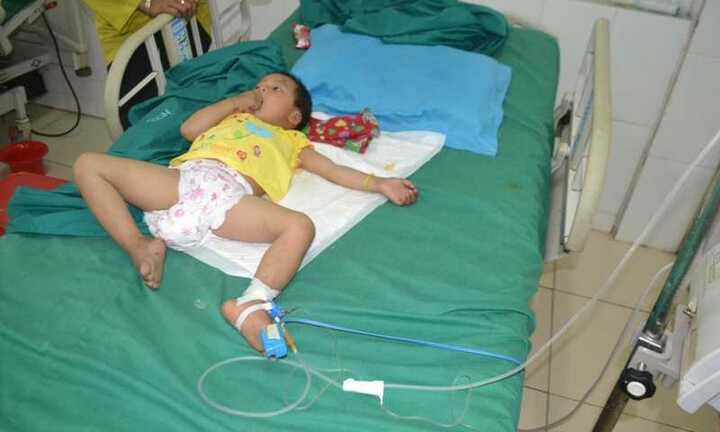 Bé gái 3 tuổi bị đạn lạc bắn xuyên đầu