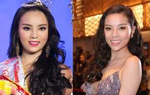 Lộ bằng chứng Hoa hậu Kỳ Duyên nói dối chuyện cằm nhọn