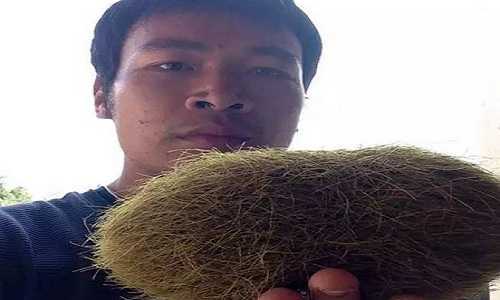 Giải mã sỏi mật 'trứng vàng' trong bụng lợn trị giá bạc tỷ