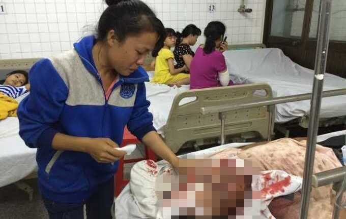 Tranh giành mua đầu trâu, một người đàn ông bị đánh chấn thương sọ não