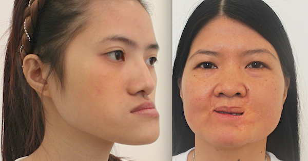 'Phép màu sắc đẹp' trao gói thẩm mỹ 1 tỷ đồng cho các nhân vật đổi đời