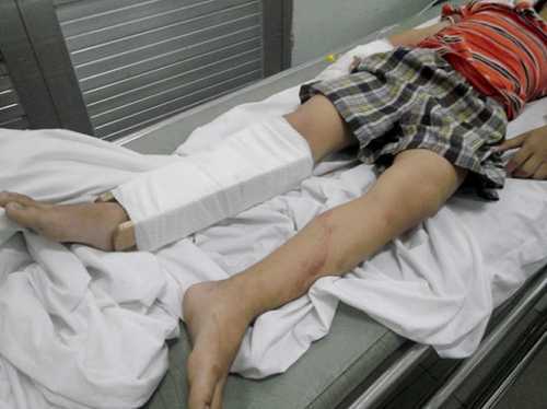 Học sinh Tiểu học Nam Trung Yên bị gãy chân: Xin miễn truy cứu hình sự cho lái xe taxi