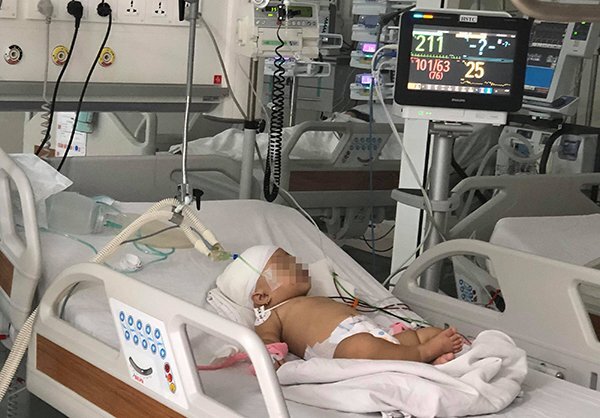 Những trường hợp bị khỉ cắn thương tâm