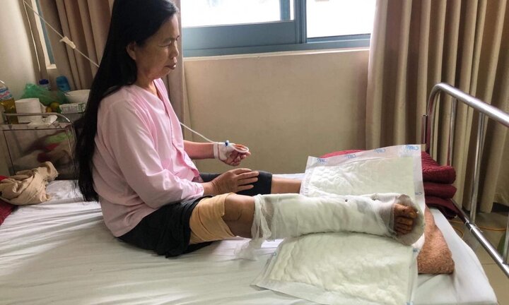 Dùng công nghệ mới cứu cụ bà bị rắn độc cắn sốc nhiễm độc